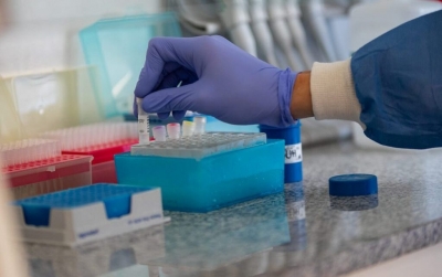 Se triplicaron los casos de Coronavirus durante marzo en Baigorria