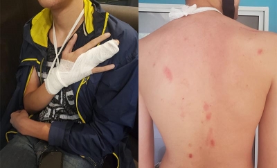 Denunciaron al marido e hijo de la concejala Anita Martínez por golpear a un adolescente